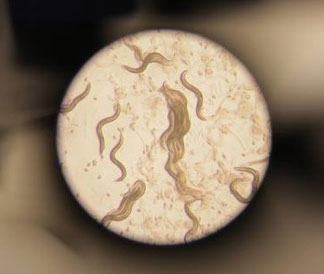 Image of a population of Caenorhabditis elegans taken through a stereomicroscope.