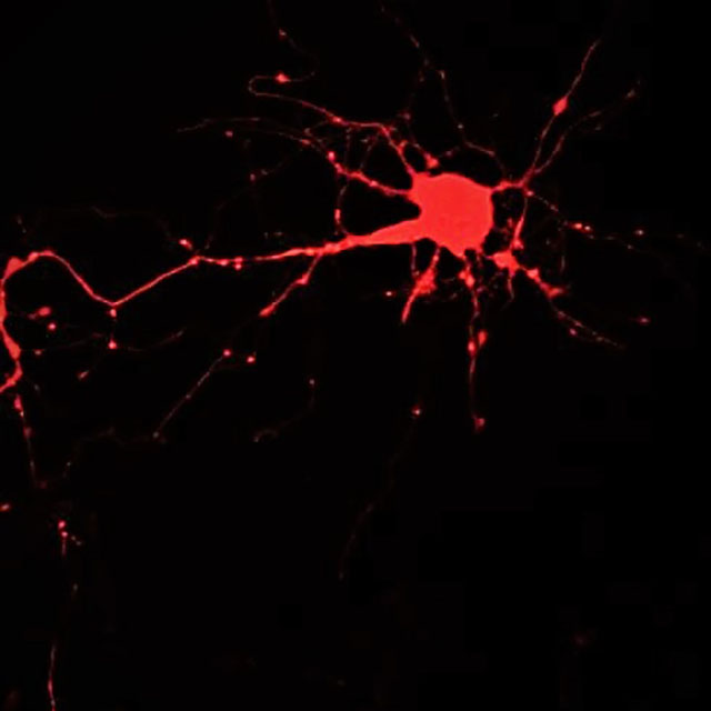 Confocal microscopic image of a mouse brain primary neuron showing mitochondria