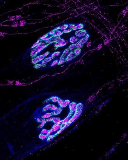 Deconvolved z-projection of confocal images 