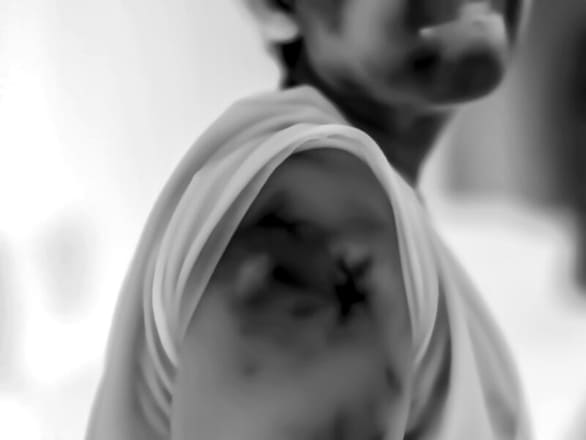 Black and white image of a person to the side, with the sleeve rolled up to show the shoulder