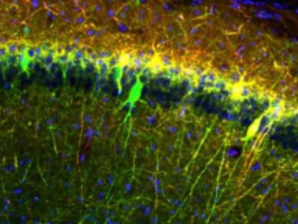 Microscopic image of neurons, colored green yellow and orange.