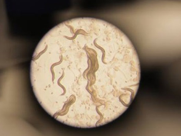 Image of a population of Caenorhabditis elegans taken through a stereomicroscope.