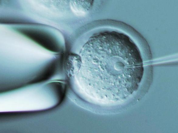 Cells being injected under a microscope