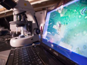 Computer screen projecting the image from a microscope with the microscope in the background