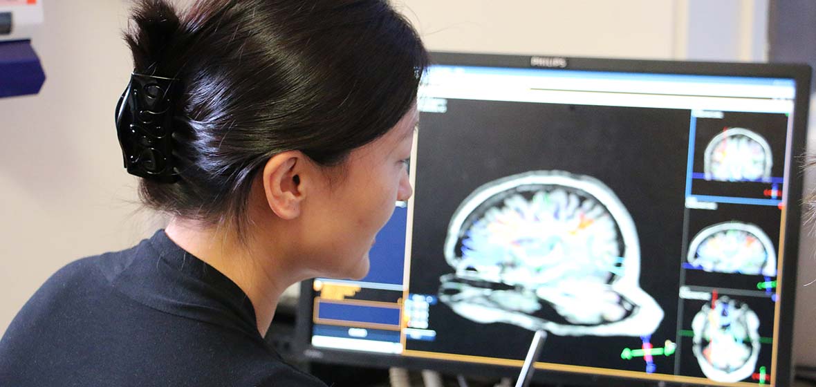 Fang Jiang studies fMRI technology images