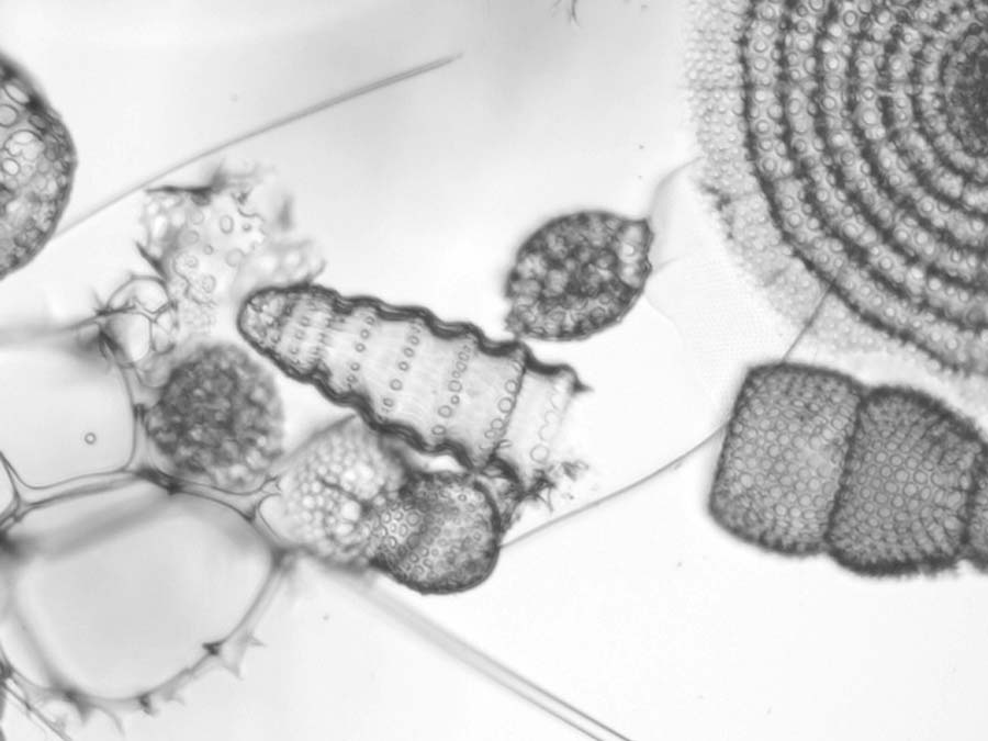Microscopic image of marine plankton.
