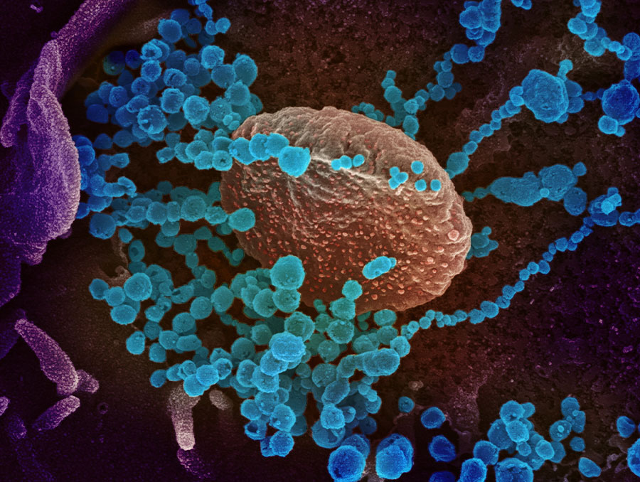 This scanning electron microscope image shows SARS-CoV-2 (round blue objects) emerging from the surface of cells cultured in the lab. SARS-CoV-2, also known as 2019-nCoV, is the virus that causes COVID-19. The virus shown was isolated from a patient in the U.S. Credit: NIAID-RML