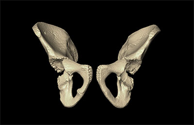pelvic bone image in database