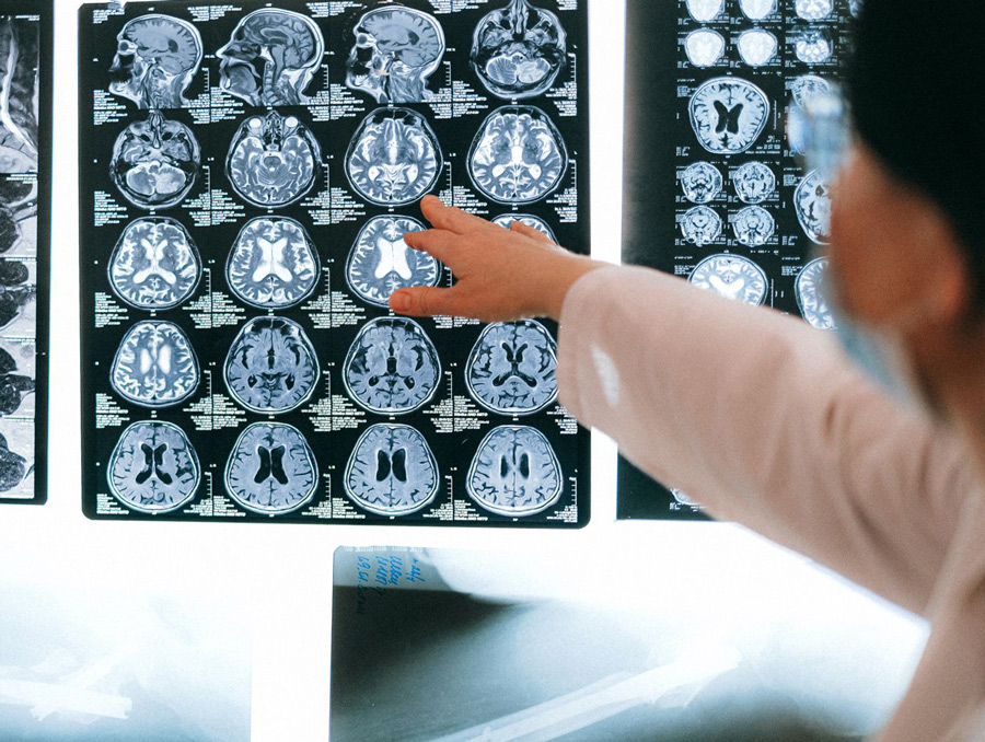 Woman points at brain scans.