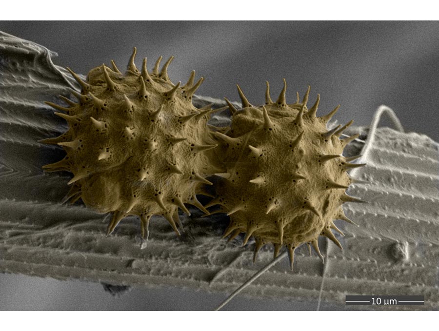 A microscopic image shows two large grains of pollen that look like spiky yellow balls on a butterfly leg, which is a straight line horizontally with grooves in it.