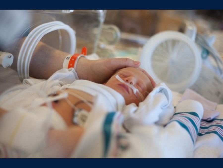 A hand holds the head of an infant with medical tubes in the nose and across the abdomen.