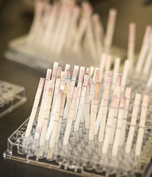 Diagnostic test strips in a stand.
