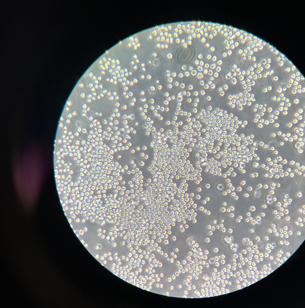 A slide from a microscope showing small white dots clustered all over it.