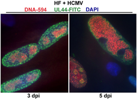By pulsing cells with a nucleoside analog (EdU), and attaching EdU to biotin prior to streptavidin purification, we are selectively isolating replicated DNA and associating proteins. aniPOND is an innovative technique for high-resolution analysis of proteins at replication forks or on mature chromatin depending on the length of the EdU pulse and chase time. Using the aniPOND technique we are currently in the process of characterizing several cellular and viral factors with respect to their involvement in viral DNA synthesis.