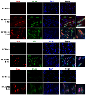 Visualization of EdU labeled DNA with viral and cellular replication proteins. Super confluent HF cells were incubated with 25uM EdU for 60 min at 3 or 5 dpi. EdU incorporation was visualized by fixing cells with 4% paraformaldehyde followed by permeabilization (0.5% Triton) and clicking Alexa Fluor 594 to EdU. Cells were incubated with the indicated primary antibodies overnight, followed by Alexa Fluor 488 secondary antibody and mounted onto glass slides using ProLong® Gold Antifade Mountant with DAPI. Images were captured using a fluorescence microscope (Carl Zeiss, Inc.) at 40X magnification; zoomed images are shown next to the merge image.